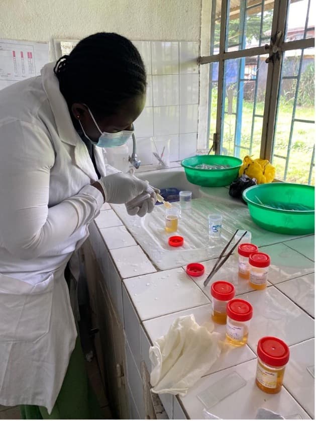Laboratory technician performing diagnostic work using membrane filtration technique for urogenital schistosomiasis